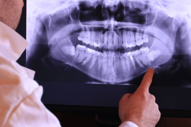 Best Emergency Treatment for Dental Infections or Abscesses in Man, IL