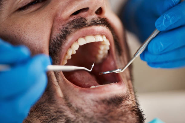 Best Emergency Root Canal Treatment in Man, IL